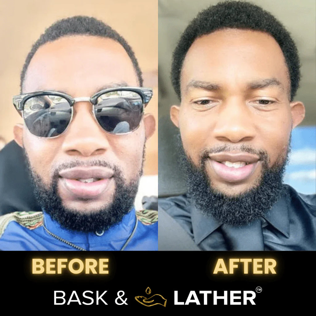 Men’S Healthy Hair & Beard Starter Kit