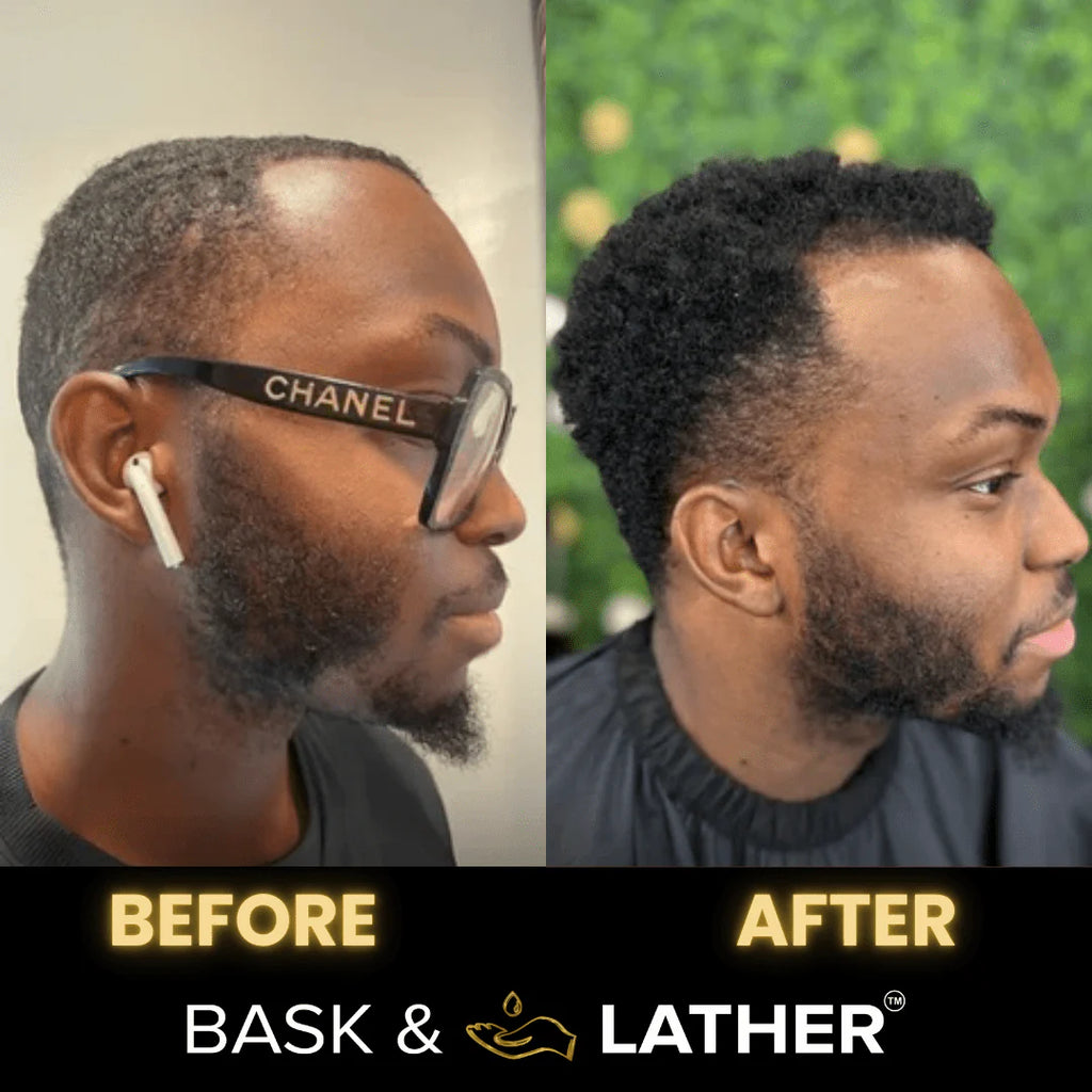 Men’S Healthy Hair & Beard Starter Kit